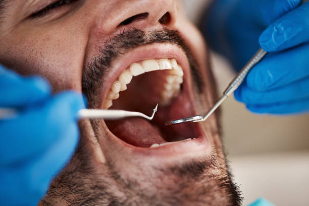 Best Urgent Dental Care for Toothache in Breckenridge, TX