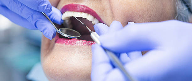 Best Broken or Cracked Tooth Emergency Dentist in Breckenridge, TX